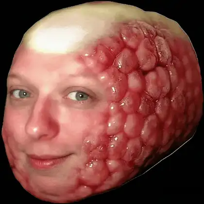 Raspberry